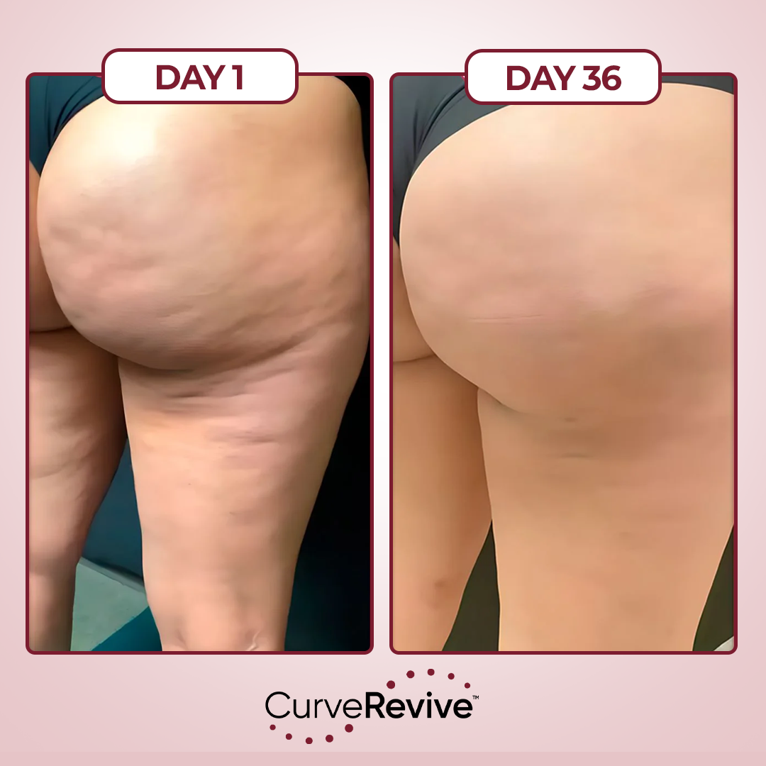 CurveRevive™ Anti-Cellulite Kit