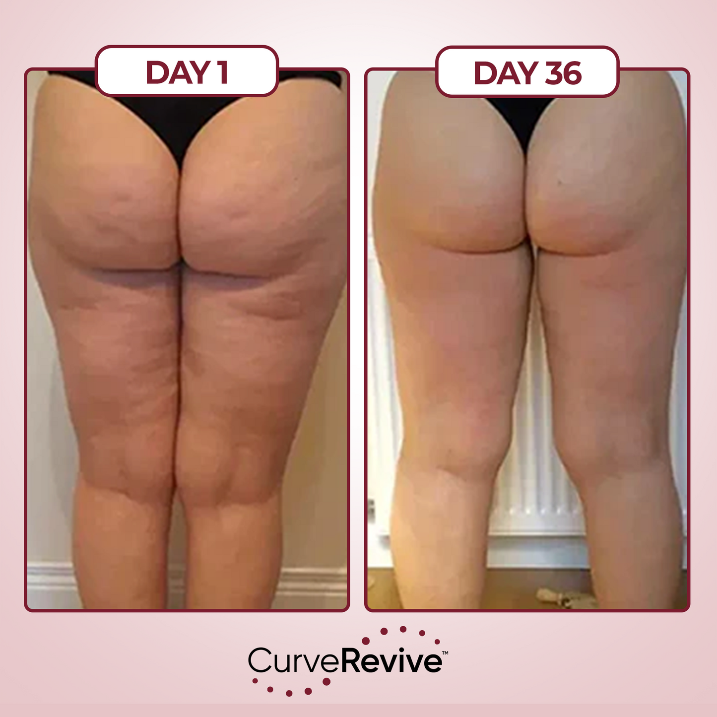 CurveRevive™ Anti-Cellulite Kit
