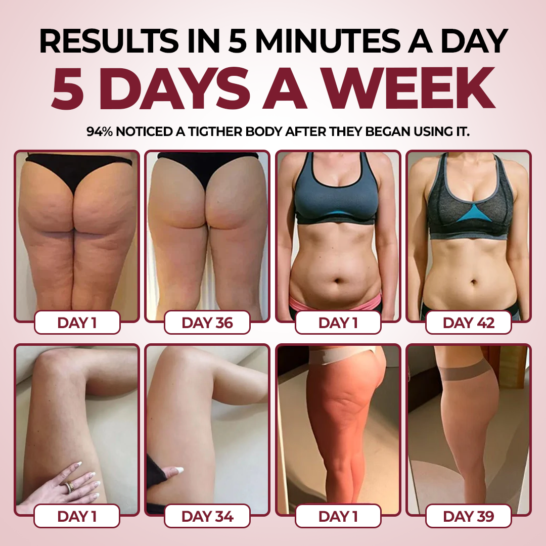 CurveRevive™ Anti-Cellulite Kit