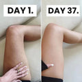 CurveRevive™ Cellulite Massage Kit - Before & After Comparison