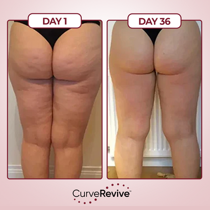 CurveRevive™ Anti-Cellulite Kit