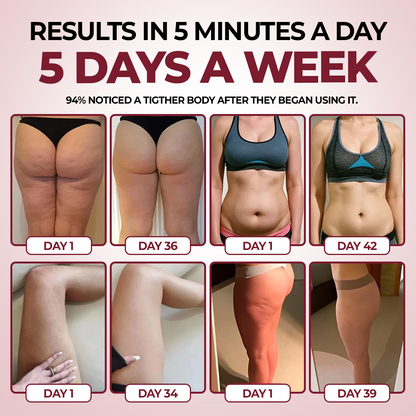CurveRevive™ Anti-Cellulite Kit